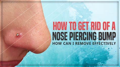 So, you got your nose pierced and now you have a bump next to it to deal with. Nose Piercing Bump: 5 Simple Remedies to Get Rid of It at ...