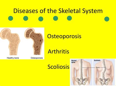 Ppt The Body Systems Powerpoint Presentation Free Download Id853376