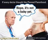 How Do Doctors Perform An Abortion Images