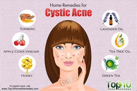 Home Remedies For Cystic Acne
