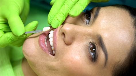 how long do porcelain veneers last west hollywood holistic and cosmetic dental care