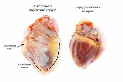 Диета почки сердце