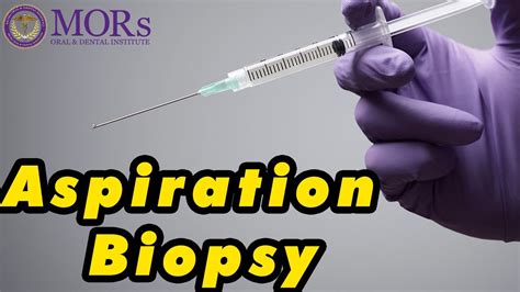 Fine Needle Aspiration Biopsy Procedure Youtube