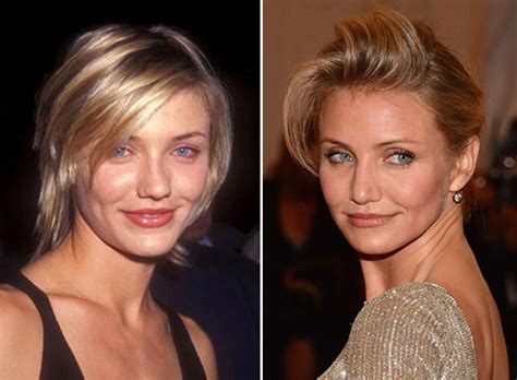 Information and translations of nose job in the most comprehensive dictionary definitions resource on the web. Top 10 Best Celebrity Nose Jobs - List