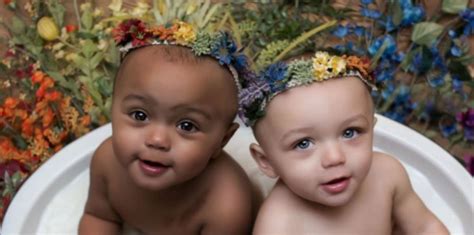 Les jumelles à la couleur de peau différente ont bien grandi depuis Page Recettes en Famille