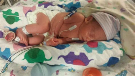 Baby Fitz Born At 33 Weeks 3 Days New Photo And Short Update Babycenter