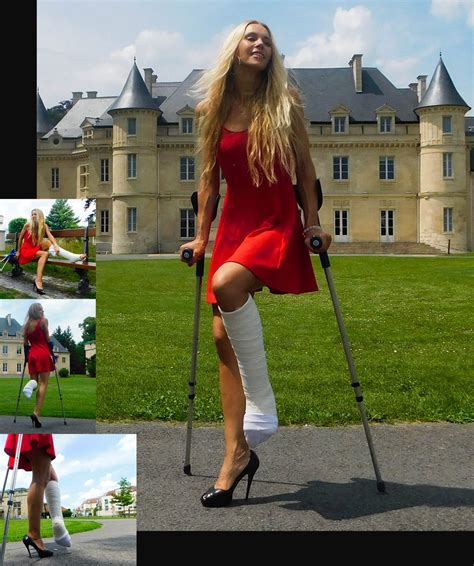 Castlinda Casts Braces Sprain Crutches Cnews