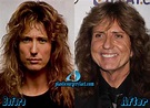 David Coverdale Plastic Surgery Before And After