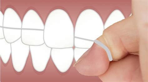 ¿por Qué Debes Usar Seda Dental En Tu Higiene Dental Mqm