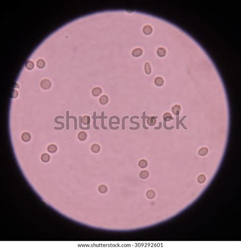 Red Blood Cells Urine Specimen Under Stock Photo Edit Now 309292601