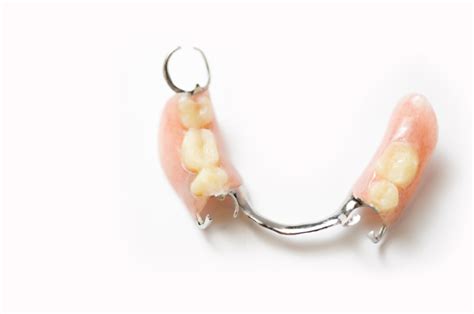 Metal Partial Vs Metal Free Partial Dentures What You Need To Know Dental Lab Direct