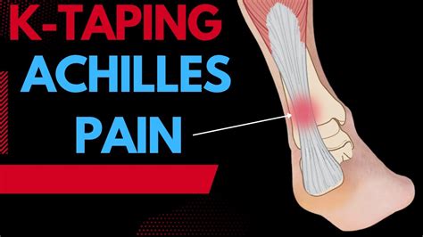 How To Treat Achilles Tendonitis Using Kinesiology Tape Youtube