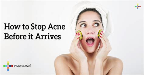 How To Stop Acne Before It Arrives