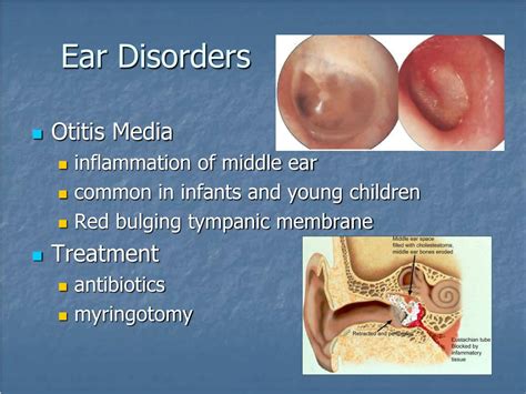 Ppt Nursing Care Of Clients With Eye And Ear Disorders Powerpoint
