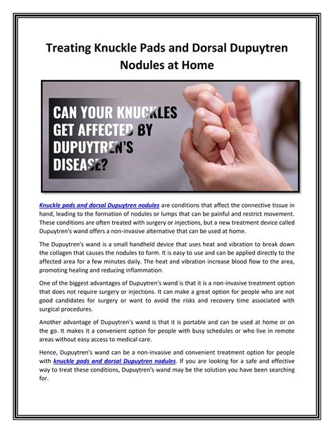 Treating Knuckle Pads And Dorsal Dupuytren Nodules At Home By