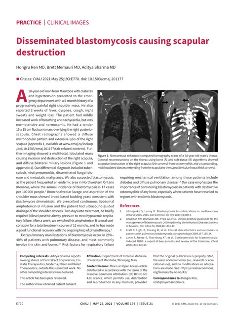 Pdf Disseminated Blastomycosis Causing Scapular Destruction