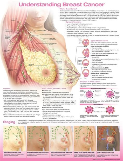 Anatomy Charts Posters Understanding Breast Cancer Anatomical Chart