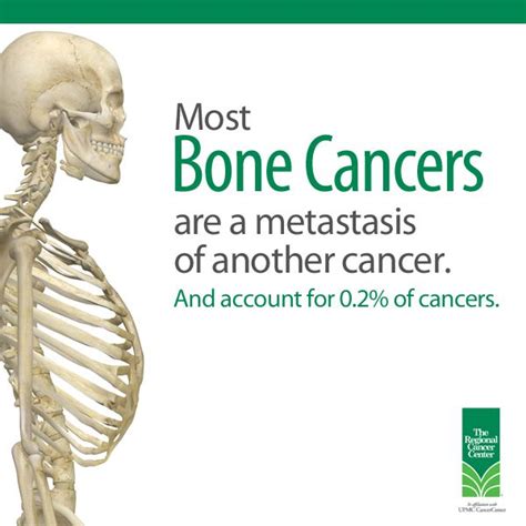 78 Best Cancer Metastasis Images On Pinterest
