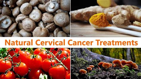 Best Natural Cervical Cancer Treatments Youtube