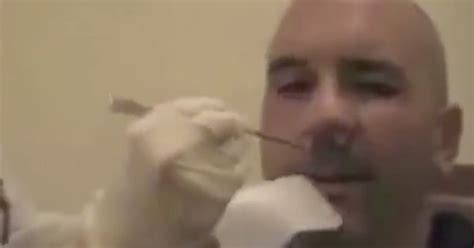 Video Of Doctor Removing 5 Foot Tapeworm From Mans Nose Goes Viral
