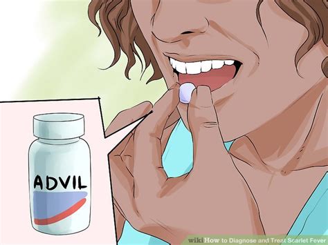 Ways To Diagnose And Treat Scarlet Fever WikiHow Health