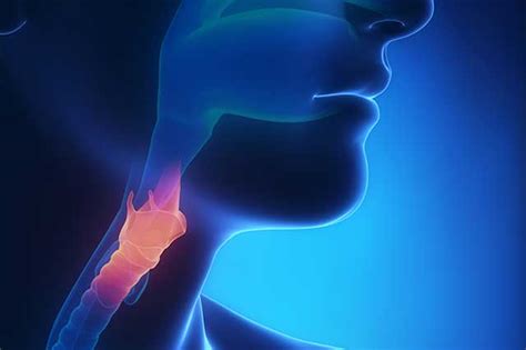 Astro Guideline Addresses Curative Treatment Of Oropharyngeal Cancer