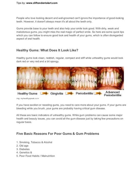 Definitive Tips For Healthy Gums