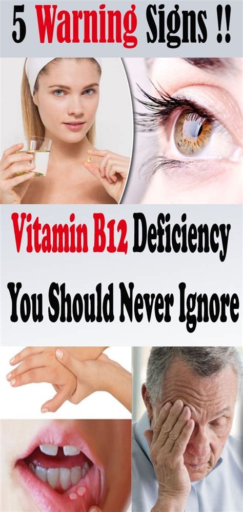 5 Warning Signs Of Vitamin B12 Deficiency You Should Never Ignore