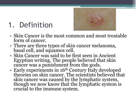 Ppt Skin Cancer Powerpoint Presentation Free Download Id3021048