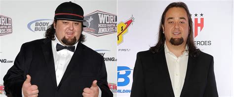Hair Loss Problem Pawn Stars Chumlee Weight Reduction