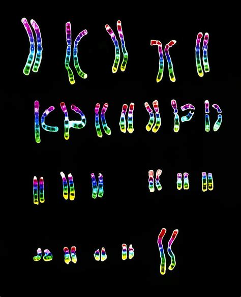 Coloured Lm Of A Normal Female Karyotype Photograph By L Willatt East Anglian Regional