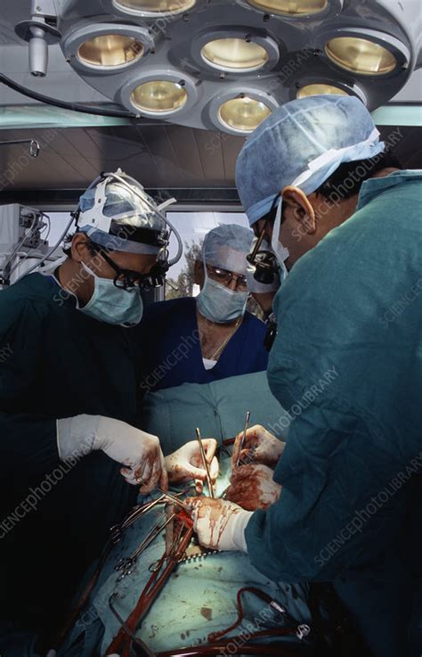 Heart valve surgery repairs a damaged heart valve. Open heart surgery - Stock Image - M560/0437 - Science Photo Library