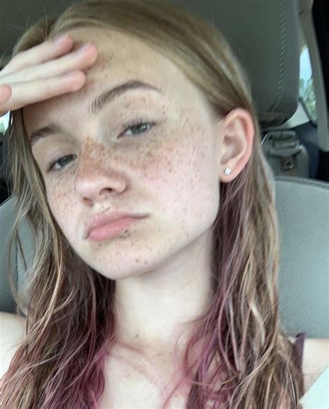 freckled cutie r freckledgirls