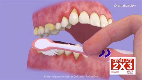 T Cnica De Cepillado Dental Youtube