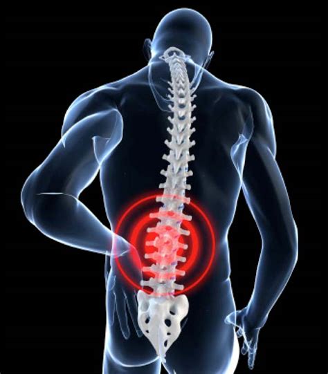 Causes Of Low Back Pain And Ways To Alleviate Them Naftulin Do