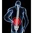 Causes Of Low Back Pain & Ways To Alleviate Them  Naftulin DO