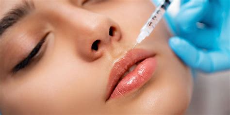 Ácido hialurónico en los labios clínica dental y estética dr omid