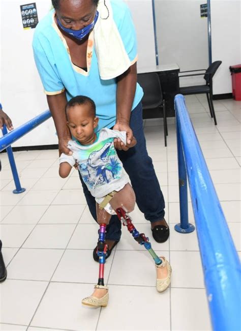 Jamaican Baby Born Without Limbs Takes First Steps Stabroek News