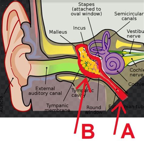 Ear Infections Medical Care One