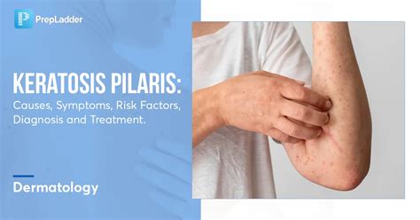 Keratosis Pilaris Causes Symptoms Risk Factors Diagnosis And Treatment