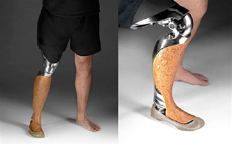 These Beautiful Customized 3d Printed Prosthetic Legs Are Made To Be