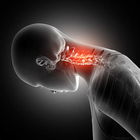 Neck Pain Can Be A Real You Know What New York Amsterdam News The