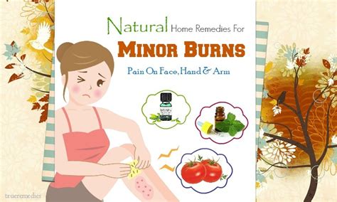 17 Home Remedies For Minor Burns Pain On Face Hand And Arm
