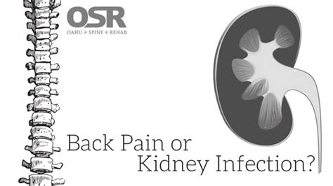 Back Pain Or Kidney Infection Oahu Spine And Rehab