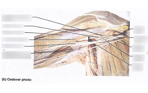 Brachial Plexus Cadaver Diagram Quizlet