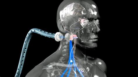 Bbc Future Cyborgs The Truth About Human Augmentation