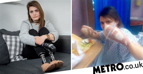 Mum 31 Lost An Arm And Both Legs After Doctors Failed To Spot Sepsis