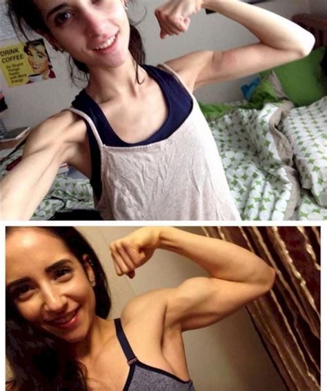 Courageous Girl Shares Her Journey From Anorexia To Bodybuilder