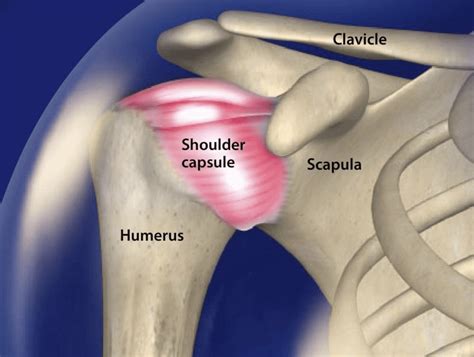 Arthroscopic Capsular Release Minimally Invasive Surgery