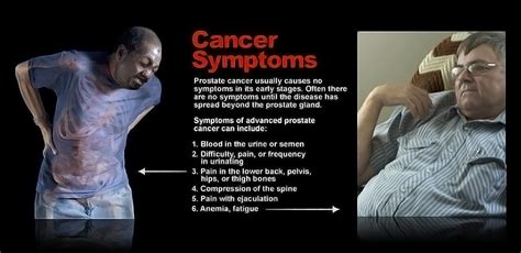 Symptoms Of Advanced Prostate Cancer Storymd